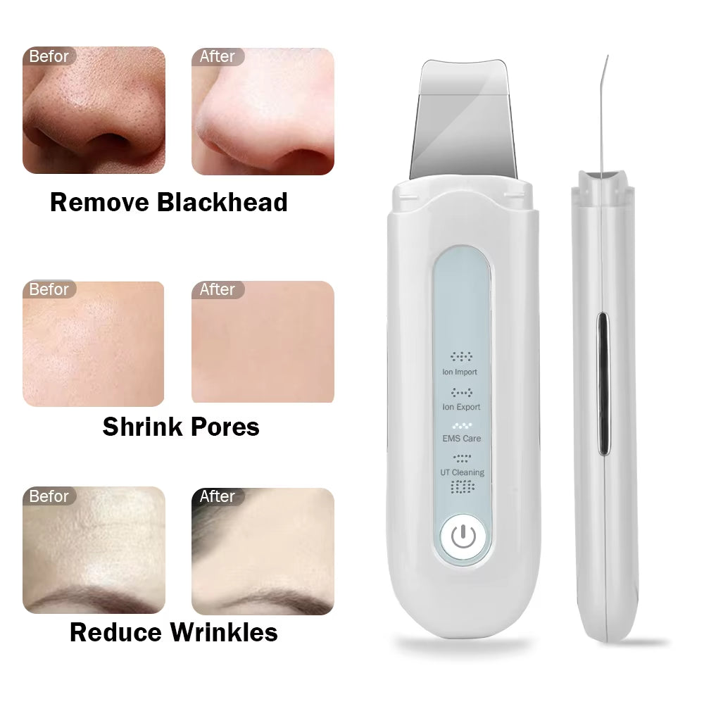 Ultrasonic Skin Scrubber High Frequency Facial Lifting Machine Beauty Pores Facial Cleanser Blackhead Remover Peeling Shovel